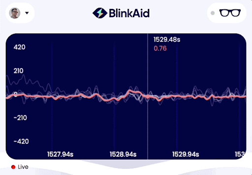 Real-time EMG signal during blink